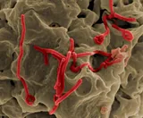 Ebola virus (SEM)
